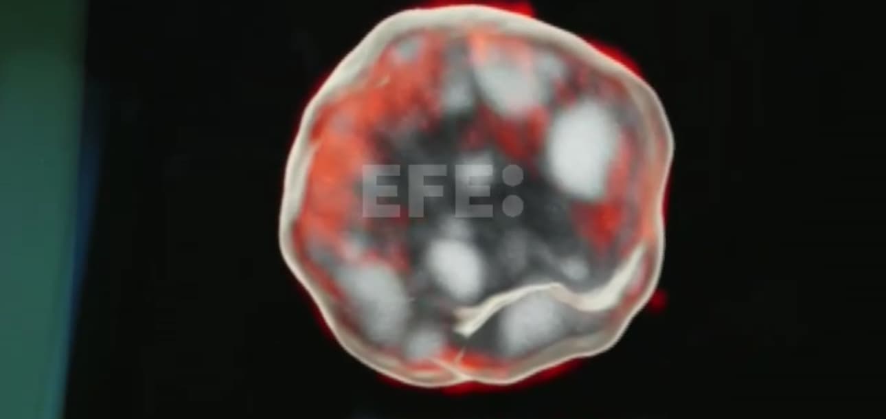 [VIDEO] Una terapia experimental logra rejuvenecer las células madre de la sangre