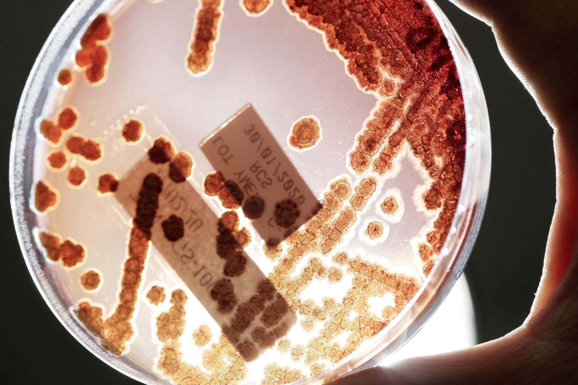 Aumentan en EE.UU. las infecciones por bacterias resistentes a los antibióticos
