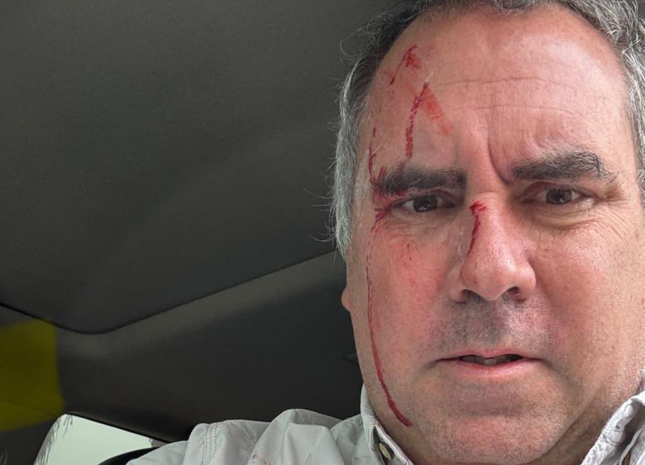 Candidato presidencial de Perú sobrevive a un atentado tras ser tiroteado en su vehículo